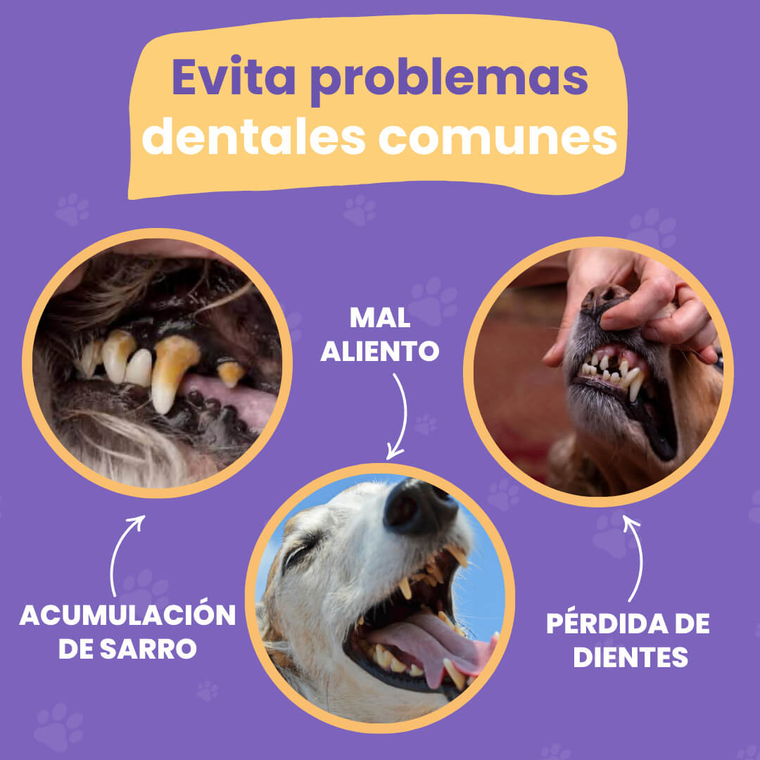 Dental Wipes