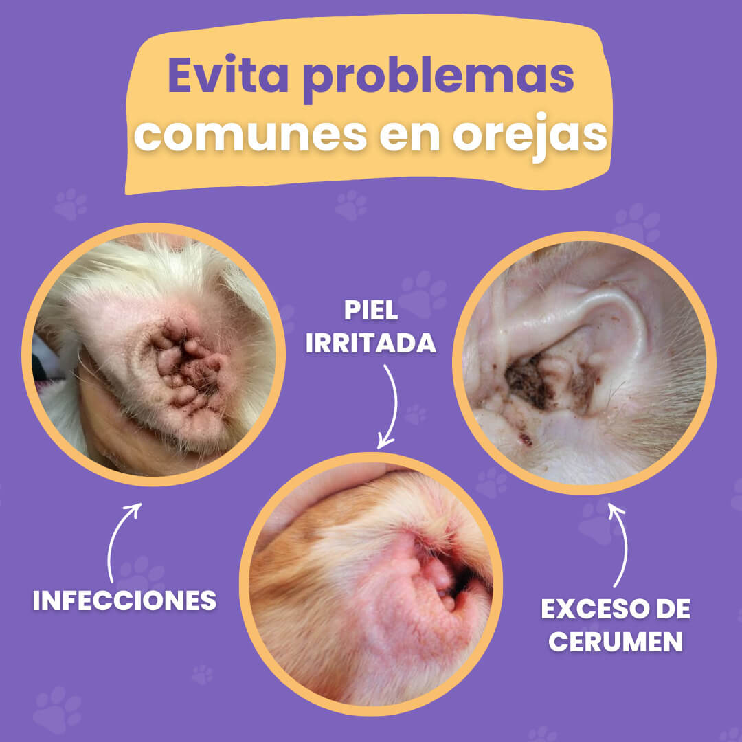 Ear Wipes