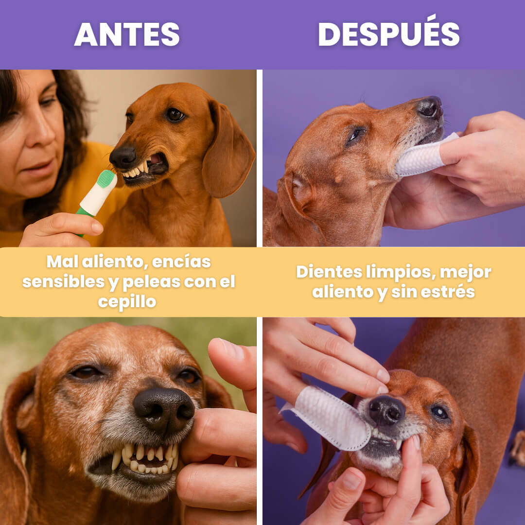 Dental Wipes